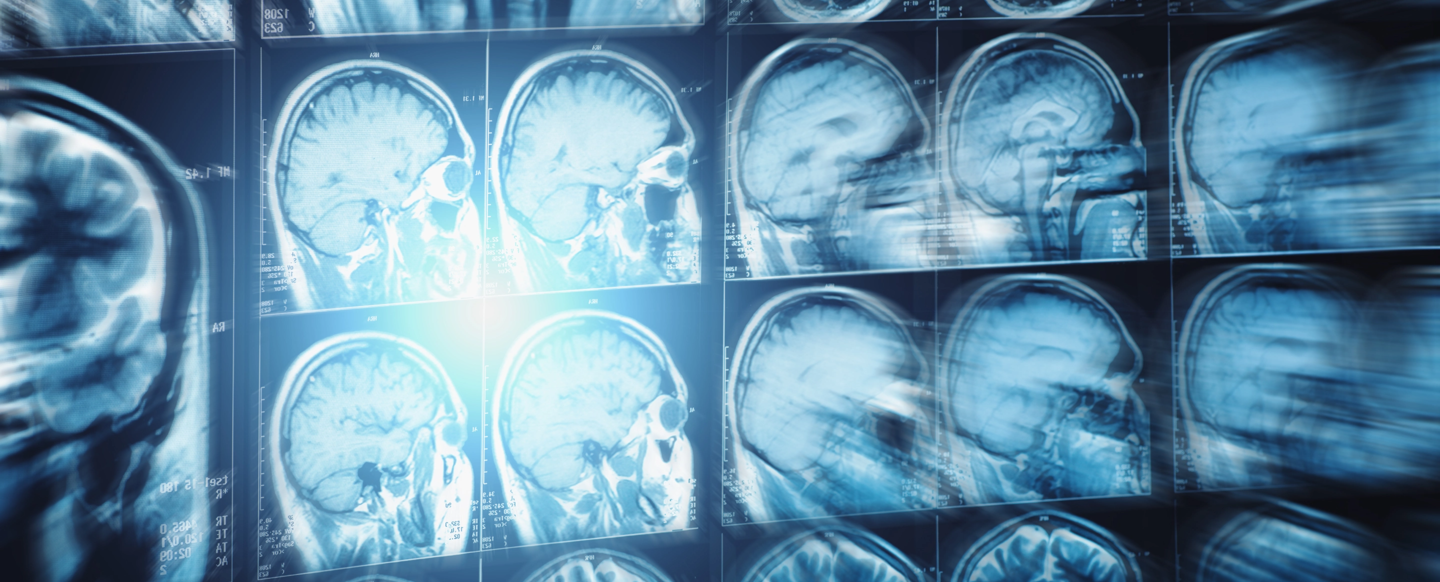 An image showing several MRIs