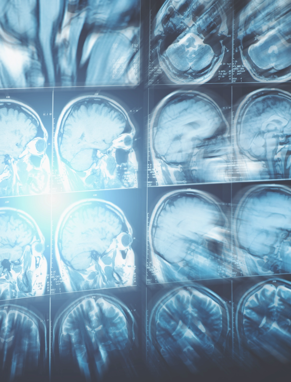 An image showing several MRIs